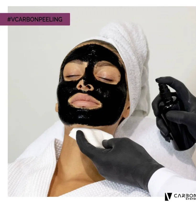 Peeling au charbon actif V Carbon
